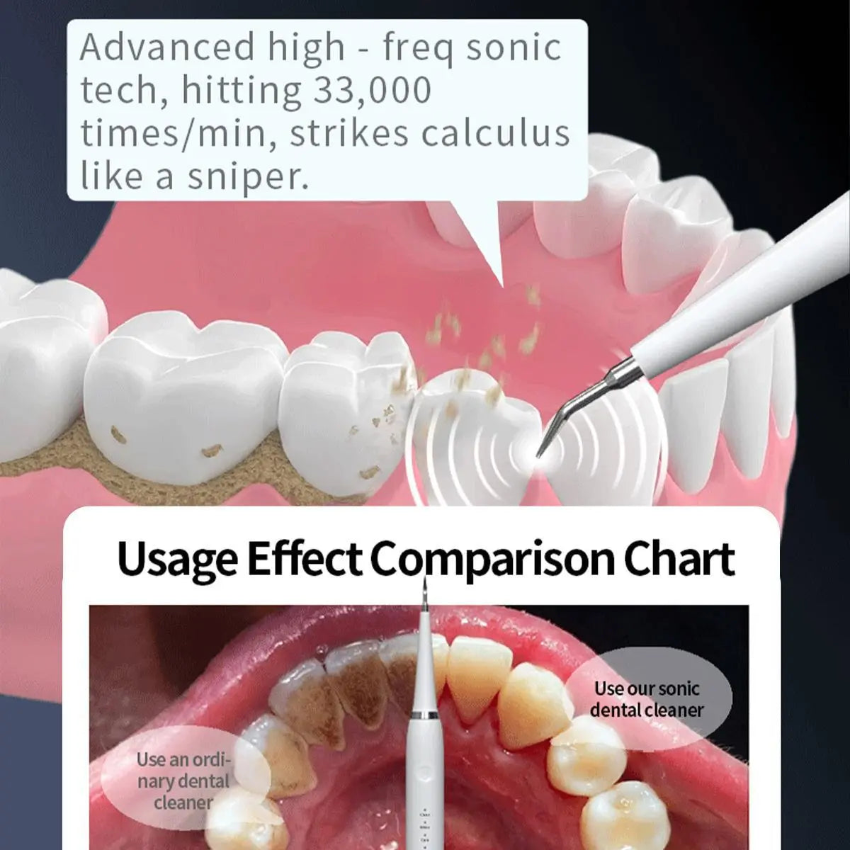 Oceantree 2-in-1 Electric Toothbrush and Ultrasonic Tartar Remover for Adults - Ultimate Dental Care Solution
